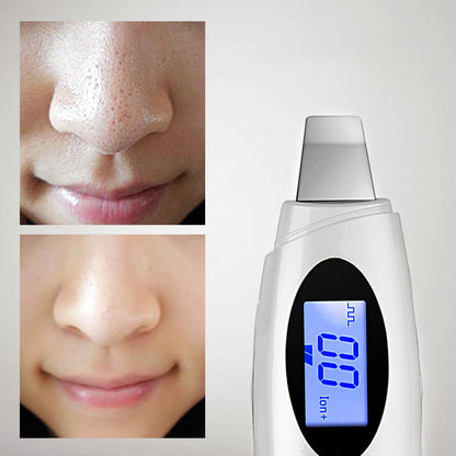 Ultrasonic beauty instrument